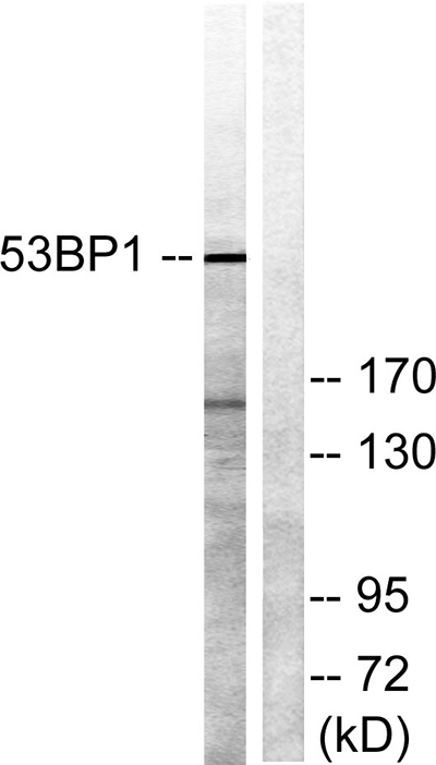 53BP1 Rabbit Polyclonal Antibody | 兔多抗 | EnkiLife恩玑生命