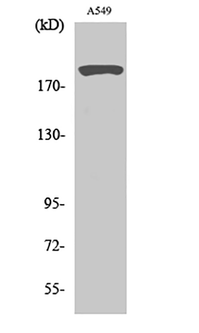 53BP1 Rabbit Polyclonal Antibody | 兔多抗 | EnkiLife恩玑生命