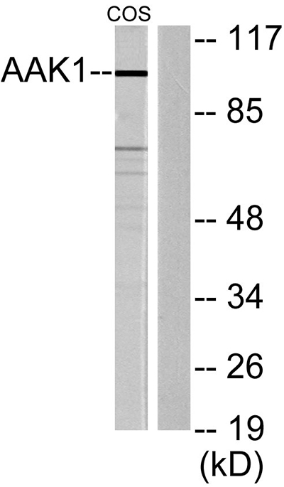 AAK1 Rabbit Polyclonal Antibody | 兔多抗 | EnkiLife恩玑生命