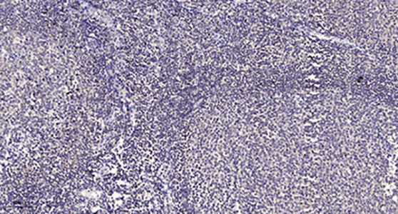 ACAD-9 Rabbit Polyclonal Antibody | 兔多抗 | EnkiLife恩玑生命