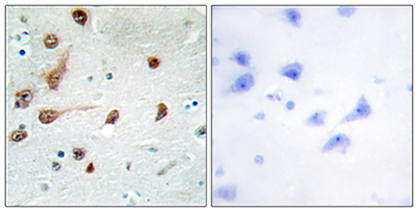 ADAR1 Rabbit Polyclonal Antibody | 兔多抗 | EnkiLife恩玑生命
