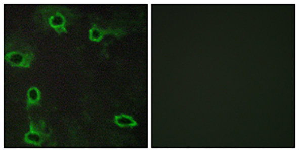 Adenosine A2A-R Rabbit Polyclonal Antibody | 兔多抗 | EnkiLife恩玑生命