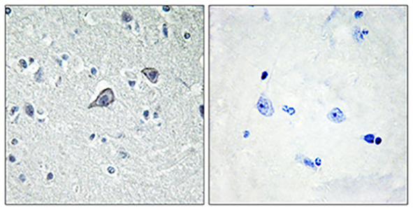 Adenosine A2A-R Rabbit Polyclonal Antibody | 兔多抗 | EnkiLife恩玑生命