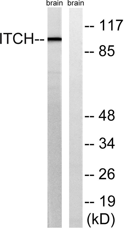AIP4 Rabbit Polyclonal Antibody | 兔多抗 | EnkiLife恩玑生命