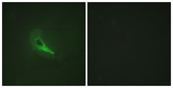 AKAP 250 Rabbit Polyclonal Antibody | 兔多抗 | EnkiLife恩玑生命