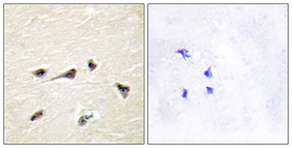 AKAP 250 Rabbit Polyclonal Antibody | 兔多抗 | EnkiLife恩玑生命