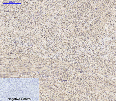 Akt1 Rabbit Polyclonal Antibody | 兔多抗 | EnkiLife恩玑生命