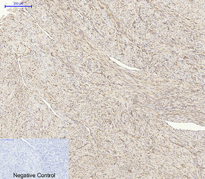 Akt1 Rabbit Polyclonal Antibody | 兔多抗 | EnkiLife恩玑生命