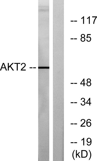 Akt2 Rabbit Polyclonal Antibody | 兔多抗 | EnkiLife恩玑生命