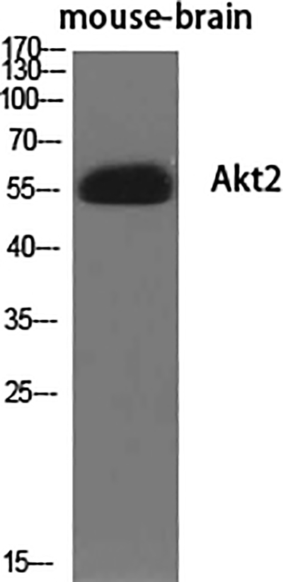 Akt2 Rabbit Polyclonal Antibody | 兔多抗 | EnkiLife恩玑生命