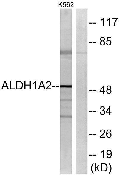 ALDH1A2 Rabbit Polyclonal Antibody | 兔多抗 | EnkiLife恩玑生命
