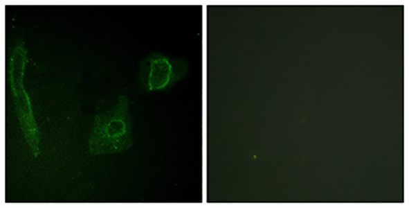 ALK Rabbit Polyclonal Antibody | 兔多抗 | EnkiLife恩玑生命