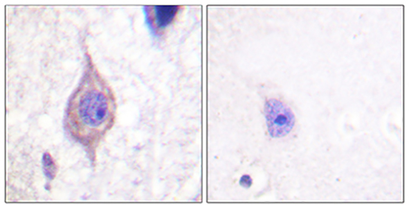 ALK Rabbit Polyclonal Antibody | 兔多抗 | EnkiLife恩玑生命