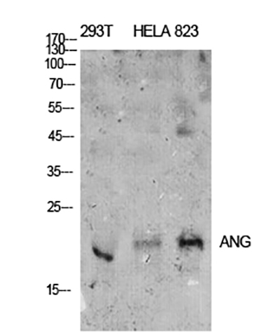 ANG I Rabbit Polyclonal Antibody | 兔多抗 | EnkiLife恩玑生命