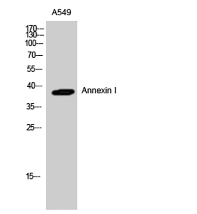 Annexin I Rabbit Polyclonal Antibody | 兔多抗 | EnkiLife恩玑生命