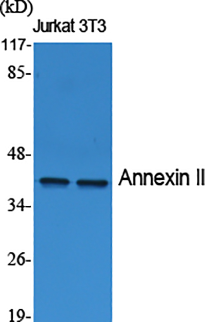 Annexin II Rabbit Polyclonal Antibody | 兔多抗 | EnkiLife恩玑生命