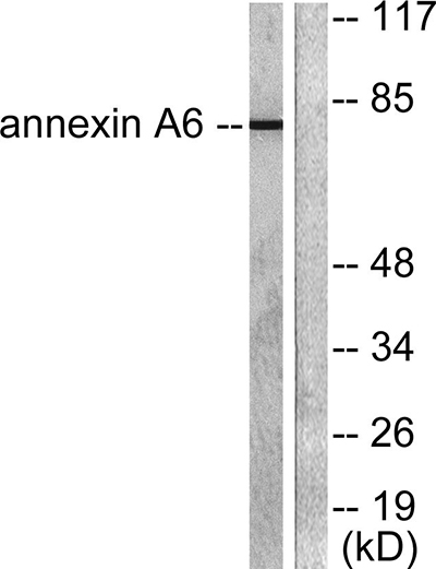 Annexin VI Rabbit Polyclonal Antibody | 兔多抗 | EnkiLife恩玑生命