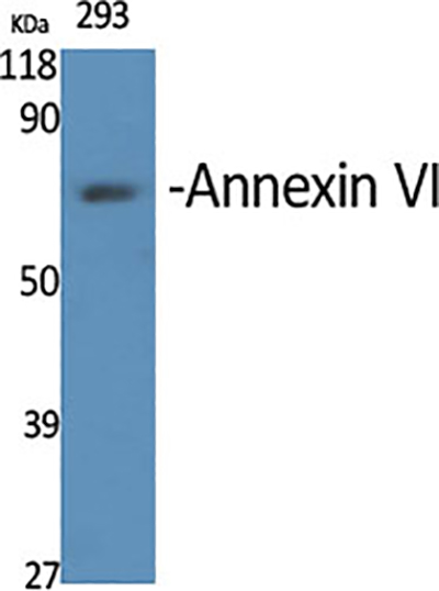 Annexin VI Rabbit Polyclonal Antibody | 兔多抗 | EnkiLife恩玑生命