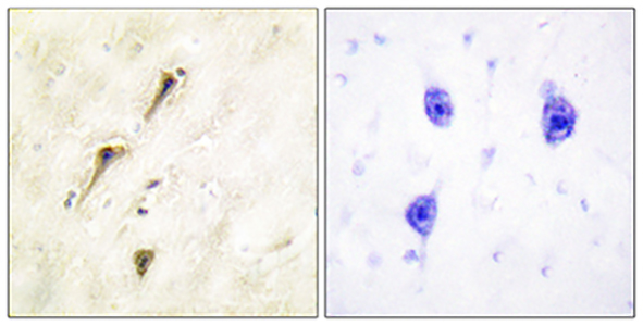 APC1 Rabbit Polyclonal Antibody | 兔多抗 | EnkiLife恩玑生命