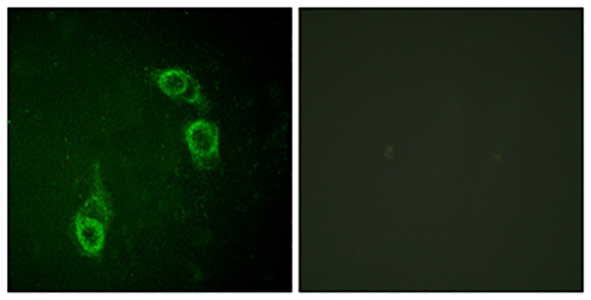 APC1 Rabbit Polyclonal Antibody | 兔多抗 | EnkiLife恩玑生命