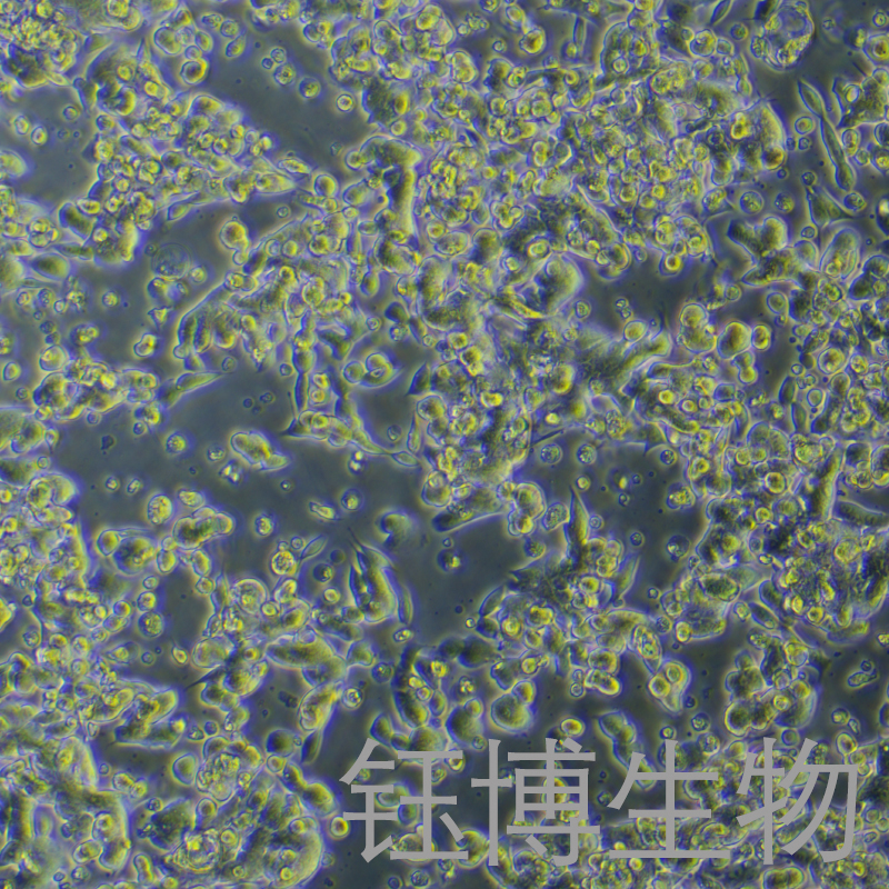 IM95m（人胃癌细胞）YB-72026HC