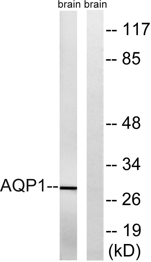 AQP1 Rabbit Polyclonal Antibody | 兔多抗 | EnkiLife恩玑生命