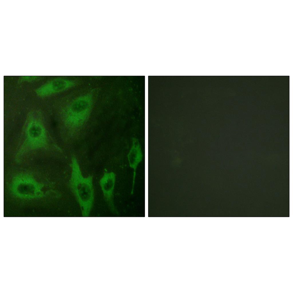 AQP2 Rabbit Polyclonal Antibody | 兔多抗 | EnkiLife恩玑生命