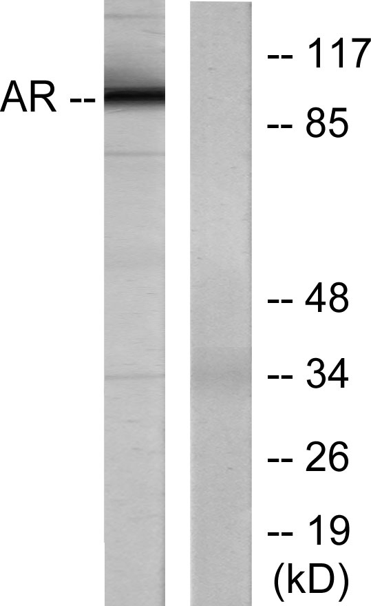 AR Rabbit Polyclonal Antibody | 兔多抗 | EnkiLife恩玑生命