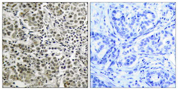 AR Rabbit Polyclonal Antibody | 兔多抗 | EnkiLife恩玑生命