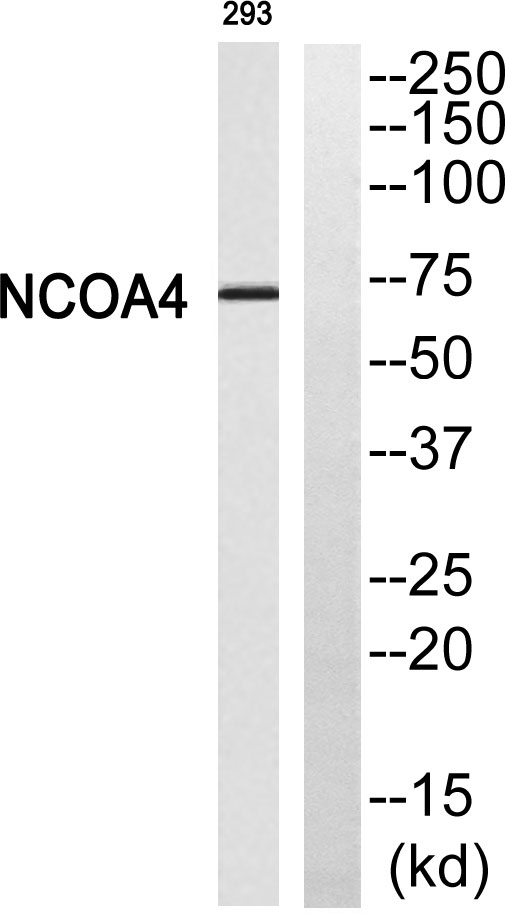 ARA70 Rabbit Polyclonal Antibody | 兔多抗 | EnkiLife恩玑生命