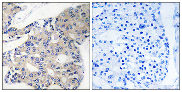 ARA70 Rabbit Polyclonal Antibody | 兔多抗 | EnkiLife恩玑生命