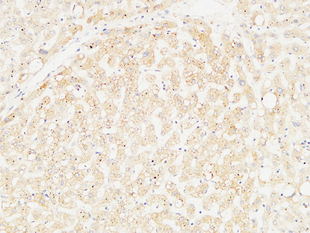 Arginase I Rabbit Polyclonal Antibody | 兔多抗 | EnkiLife恩玑生命