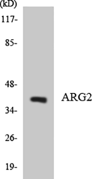 Arginase II Rabbit Polyclonal Antibody | 兔多抗 | EnkiLife恩玑生命
