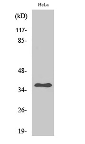 Arginase II Rabbit Polyclonal Antibody | 兔多抗 | EnkiLife恩玑生命