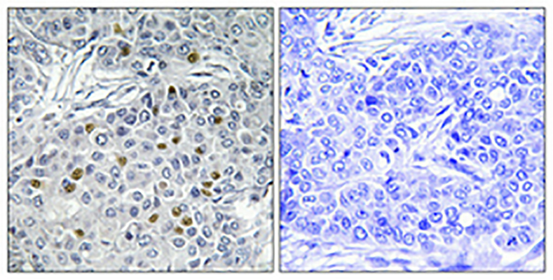 ARK-1 Rabbit Polyclonal Antibody | 兔多抗 | EnkiLife恩玑生命