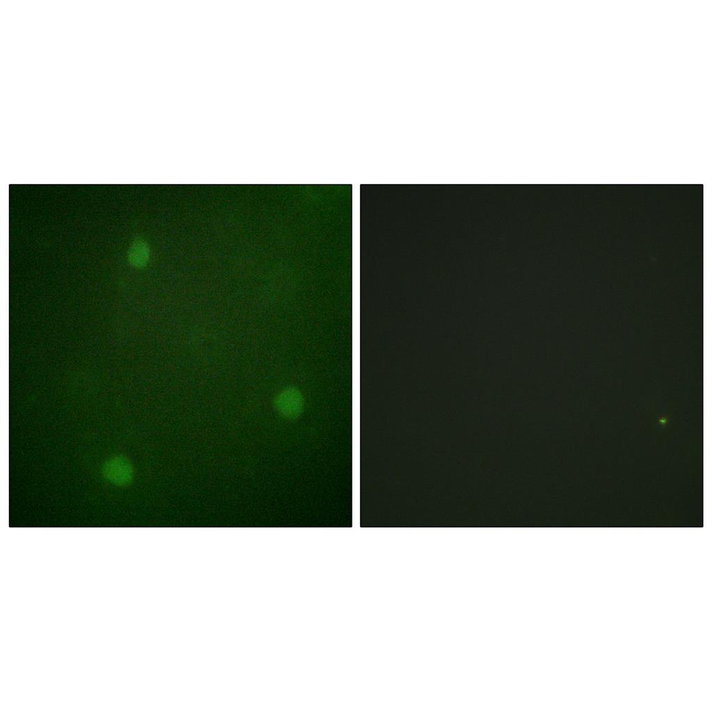 Artemis Rabbit Polyclonal Antibody | 兔多抗 | EnkiLife恩玑生命