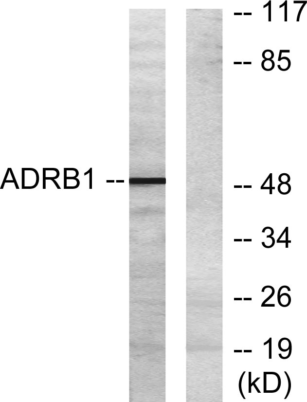 AR-β1 Rabbit Polyclonal Antibody | 兔多抗 | EnkiLife恩玑生命