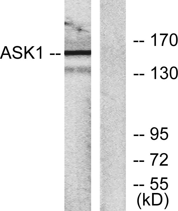 ASK 1 Rabbit Polyclonal Antibody | 兔多抗 | EnkiLife恩玑生命
