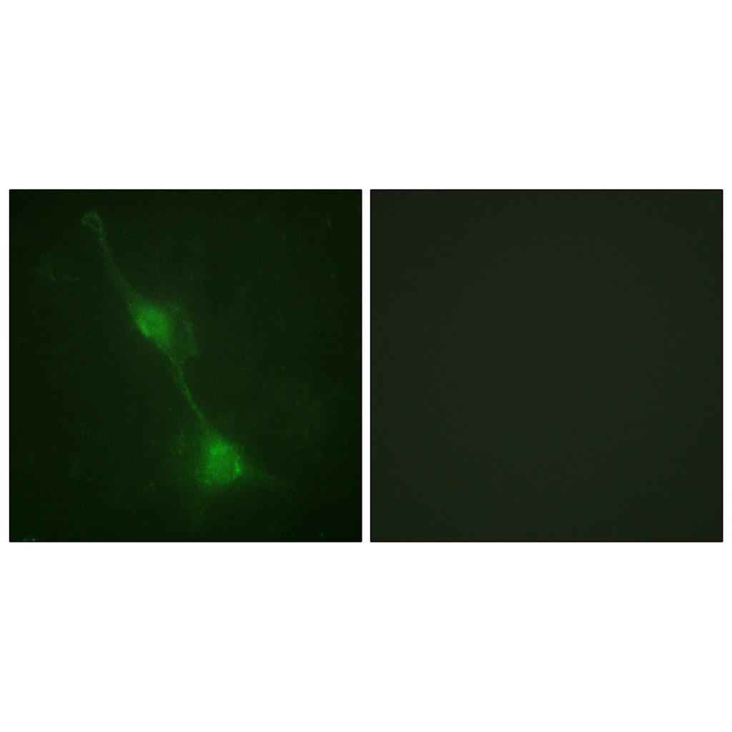 Ataxin-1 Rabbit Polyclonal Antibody | 兔多抗 | EnkiLife恩玑生命