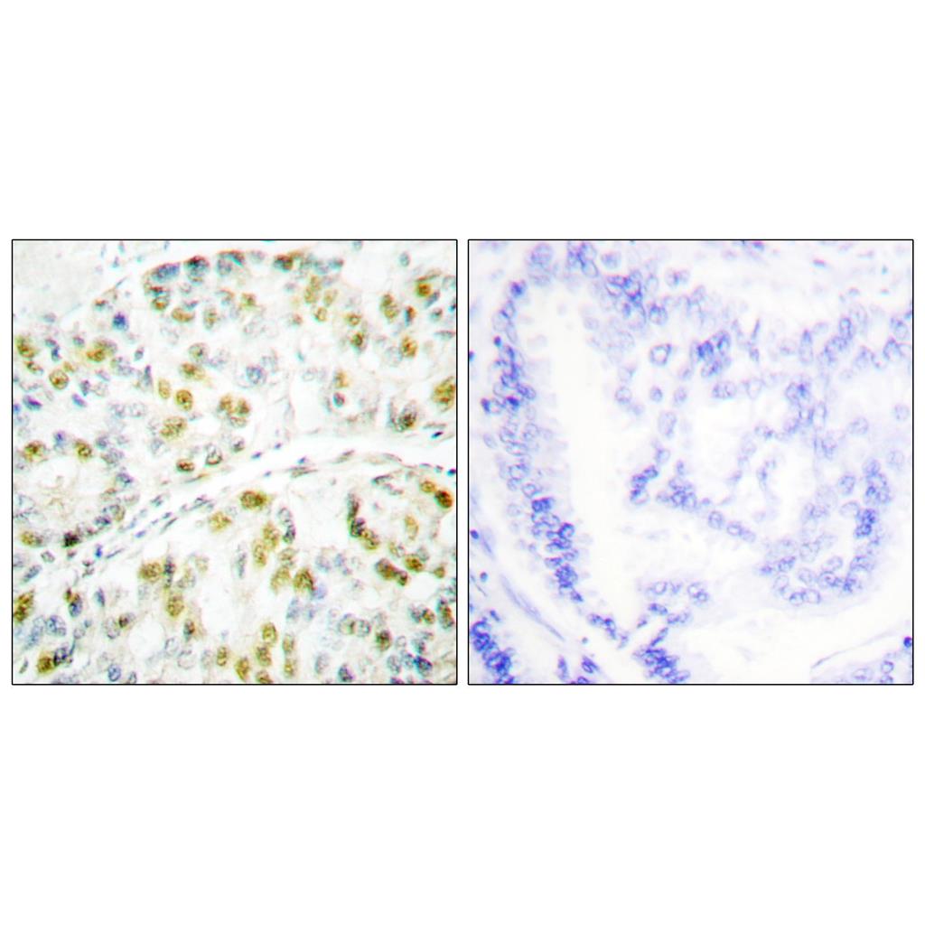 Ataxin-1 Rabbit Polyclonal Antibody | 兔多抗 | EnkiLife恩玑生命