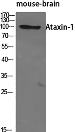 Ataxin-1 Rabbit Polyclonal Antibody | 兔多抗 | EnkiLife恩玑生命