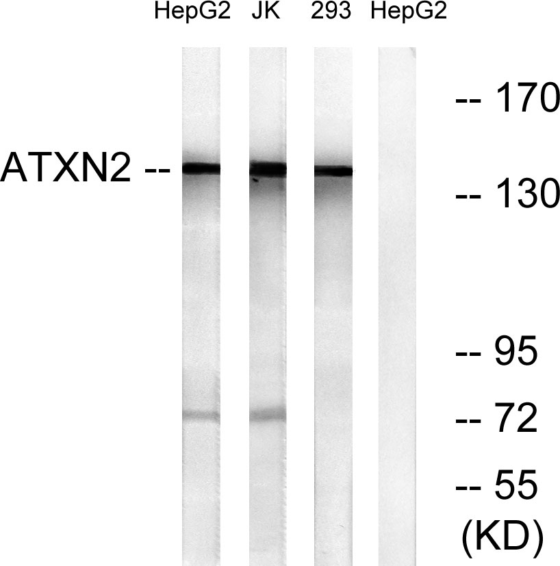 Ataxin-2 Rabbit Polyclonal Antibody | 兔多抗 | EnkiLife恩玑生命