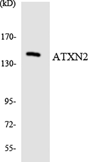 Ataxin-2 Rabbit Polyclonal Antibody | 兔多抗 | EnkiLife恩玑生命