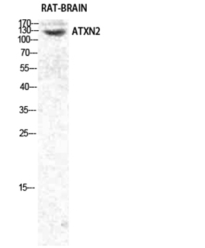 Ataxin-2 Rabbit Polyclonal Antibody | 兔多抗 | EnkiLife恩玑生命