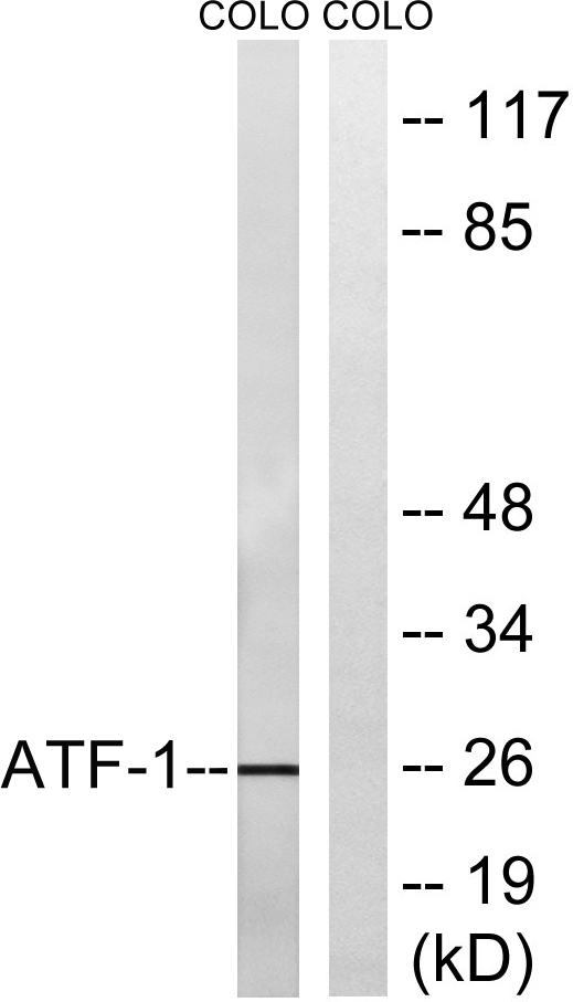 ATF-1 Rabbit Polyclonal Antibody | 兔多抗 | EnkiLife恩玑生命
