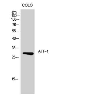 ATF-1 Rabbit Polyclonal Antibody | 兔多抗 | EnkiLife恩玑生命