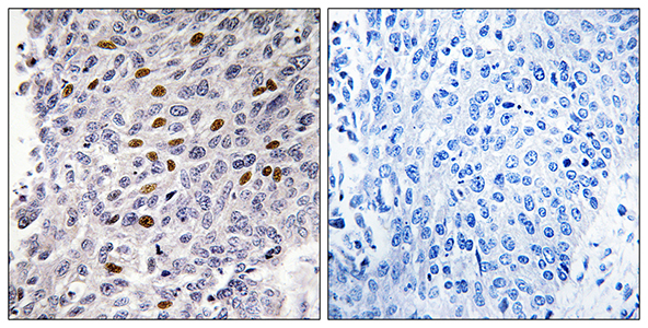 ATF-1 Rabbit Polyclonal Antibody | 兔多抗 | EnkiLife恩玑生命