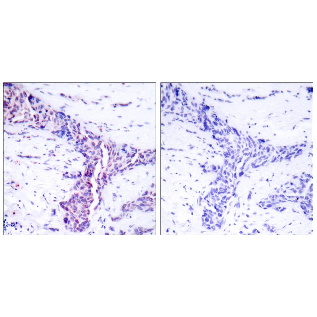 ATF-2 Rabbit Polyclonal Antibody | 兔多抗 | EnkiLife恩玑生命