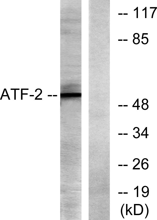 ATF-2 Rabbit Polyclonal Antibody | 兔多抗 | EnkiLife恩玑生命