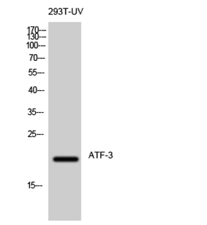 ATF-3 Rabbit Polyclonal Antibody | 兔多抗 | EnkiLife恩玑生命
